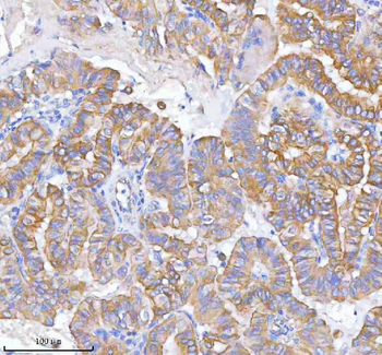 MLKL Rabbit Polyclonal Antibody