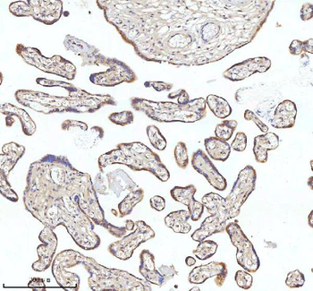 MIPEP Rabbit Polyclonal Antibody