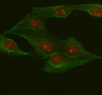 METTL18 Rabbit Polyclonal Antibody