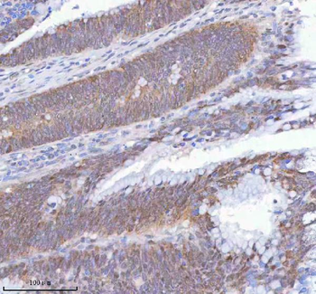 METTL18 Rabbit Polyclonal Antibody
