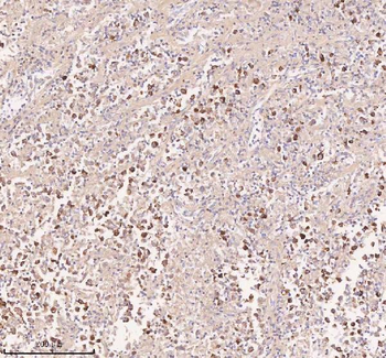 IRS4 Rabbit Polyclonal Antibody