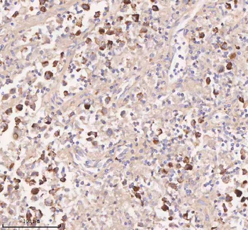 IRS4 Rabbit Polyclonal Antibody