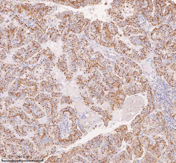 IRS4 Rabbit Polyclonal Antibody