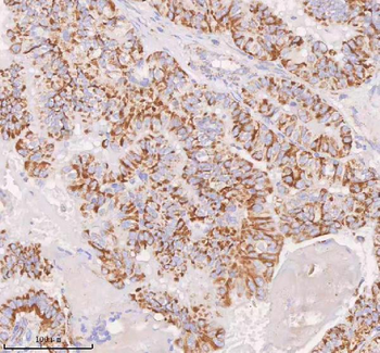 IRS4 Rabbit Polyclonal Antibody