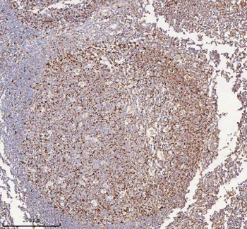 IRS4 Rabbit Polyclonal Antibody