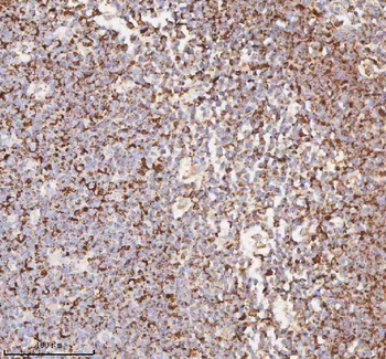IRS4 Rabbit Polyclonal Antibody