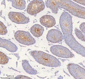 IRS4 Rabbit Polyclonal Antibody