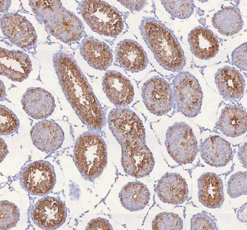 IRS4 Rabbit Polyclonal Antibody