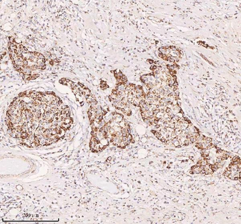 IRS4 Rabbit Polyclonal Antibody