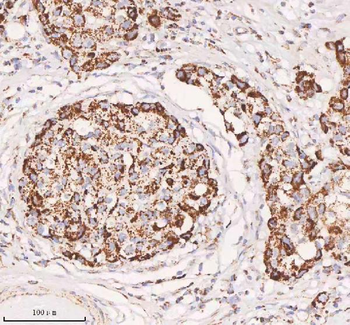 IRS4 Rabbit Polyclonal Antibody