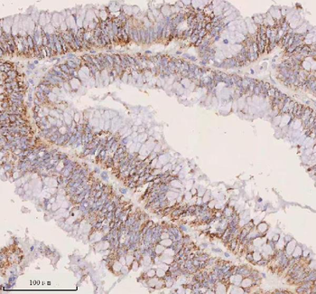 IRS4 Rabbit Polyclonal Antibody
