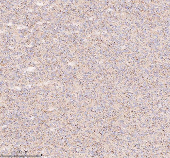IRS4 Rabbit Polyclonal Antibody