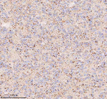 IRS4 Rabbit Polyclonal Antibody