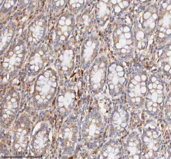 CD127/IL7R Rabbit Polyclonal Antibody