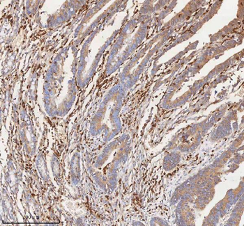 CD127/IL7R Rabbit Polyclonal Antibody