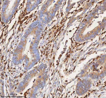 CD127/IL7R Rabbit Polyclonal Antibody