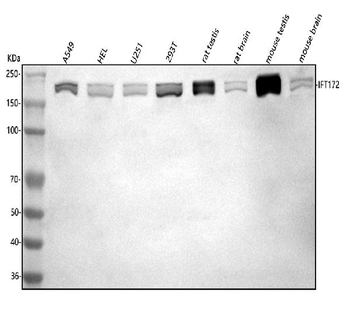 IFT172 Rabbit Polyclonal Antibody
