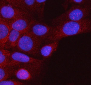 HSPA1L Rabbit Polyclonal Antibody