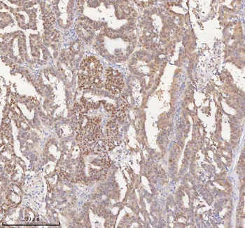 HSPA1L Rabbit Polyclonal Antibody