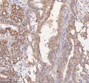 HSPA1L Rabbit Polyclonal Antibody
