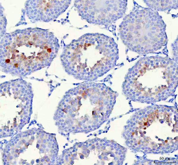 HSPA1L Rabbit Polyclonal Antibody