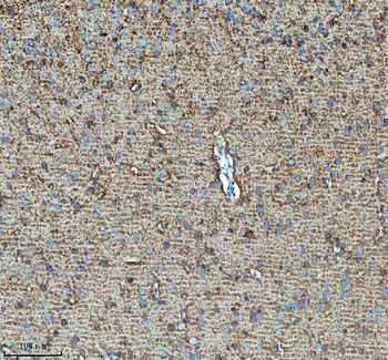 HDHD5 Rabbit Polyclonal Antibody