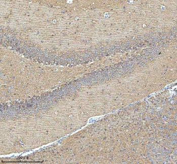 HDHD5 Rabbit Polyclonal Antibody