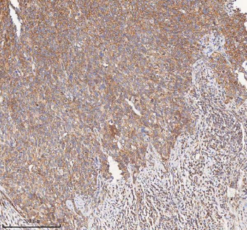 HDHD5 Rabbit Polyclonal Antibody