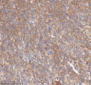 HDHD5 Rabbit Polyclonal Antibody