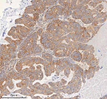 HDHD5 Rabbit Polyclonal Antibody