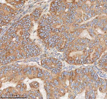 HDHD5 Rabbit Polyclonal Antibody