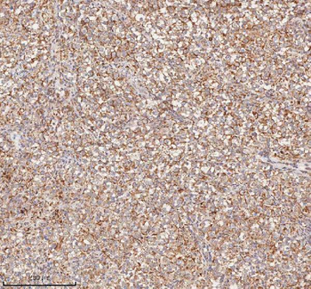 HDHD5 Rabbit Polyclonal Antibody