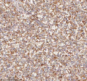HDHD5 Rabbit Polyclonal Antibody