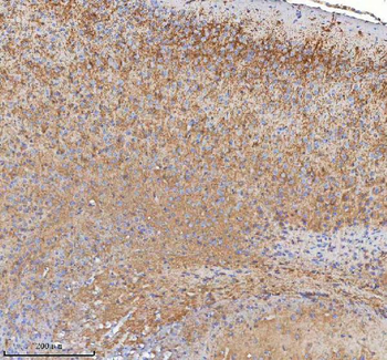 HDHD5 Rabbit Polyclonal Antibody
