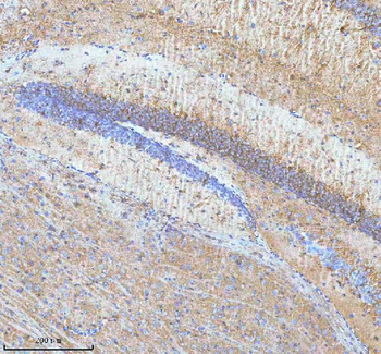 HDHD5 Rabbit Polyclonal Antibody
