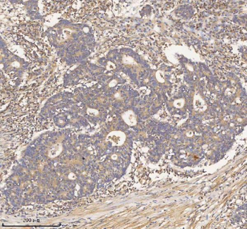 HDHD2 Rabbit Polyclonal Antibody