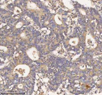 HDHD2 Rabbit Polyclonal Antibody