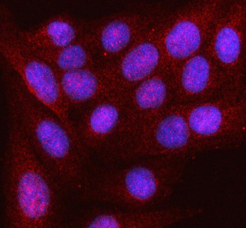 HDDC2 Rabbit Polyclonal Antibody
