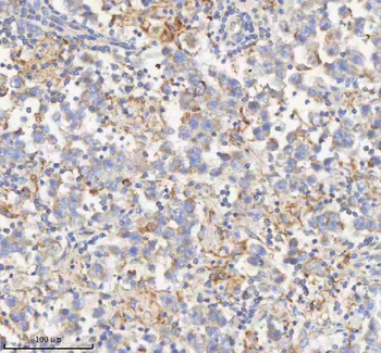 HADHB Rabbit Polyclonal Antibody
