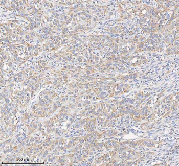 HADHB Rabbit Polyclonal Antibody