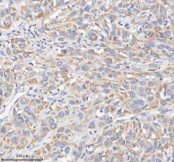 HADHB Rabbit Polyclonal Antibody
