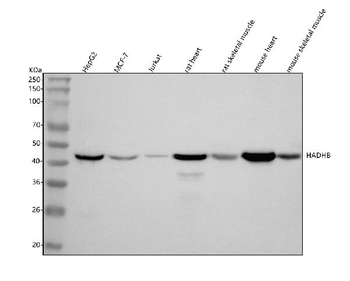 HADHB Rabbit Polyclonal Antibody