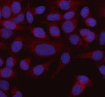 HADHB Rabbit Polyclonal Antibody