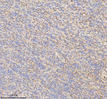 HADHB Rabbit Polyclonal Antibody