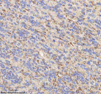 HADHB Rabbit Polyclonal Antibody