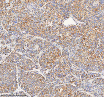 HADHB Rabbit Polyclonal Antibody