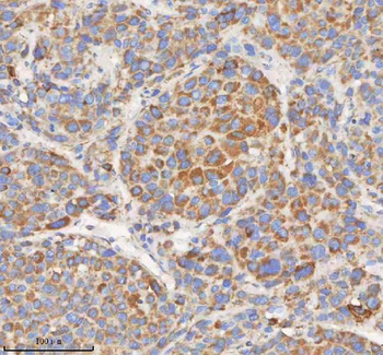HADHB Rabbit Polyclonal Antibody