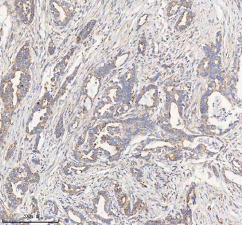 HADHB Rabbit Polyclonal Antibody