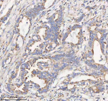 HADHB Rabbit Polyclonal Antibody