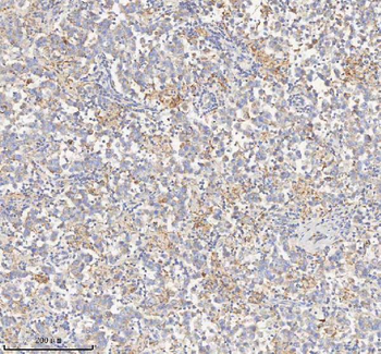 HADHB Rabbit Polyclonal Antibody